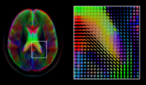 Brain imaging informatics